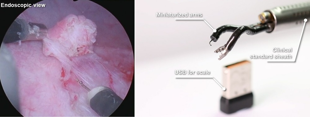 Imagen: Instrumentos robóticos miniaturizados para la cirugía endoluminal (Fotografía cortesía de Agilis Robotics)